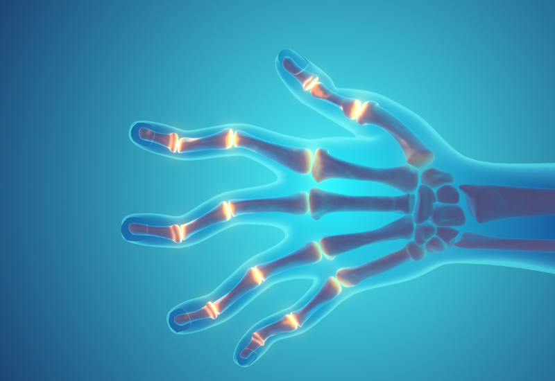 Comprehensive Arthritis Treatment