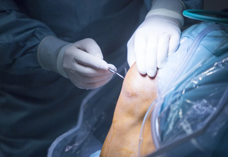 IRM Hospital - Specialized Orthopedic Surgical Treatment