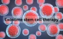 Exesome stem cells therpy