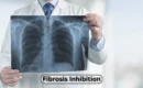 Fibrosis Inhibition