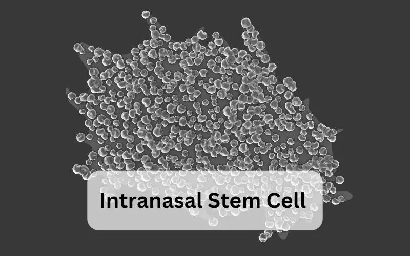 intranasal stem cell therapy