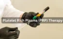 Platelet Rich Plasma Therapy