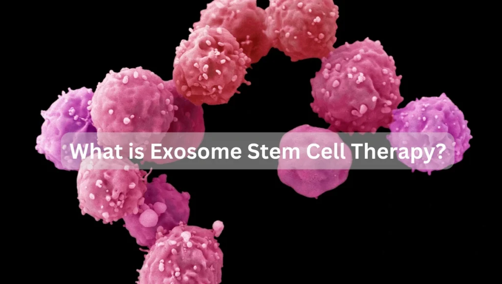 What is Exosome Stem Cell Therapy
