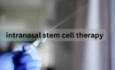 intranasal stem cell therapy