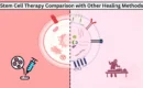 stem cell therapy Comparison