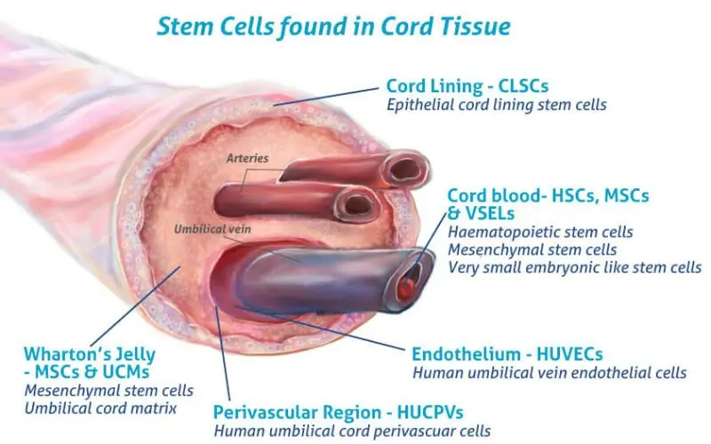 umbilical cord tissue stem cells