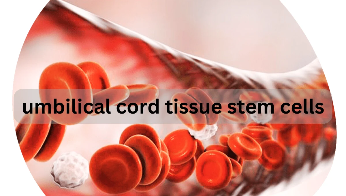 umbilical cord tissue stem cells