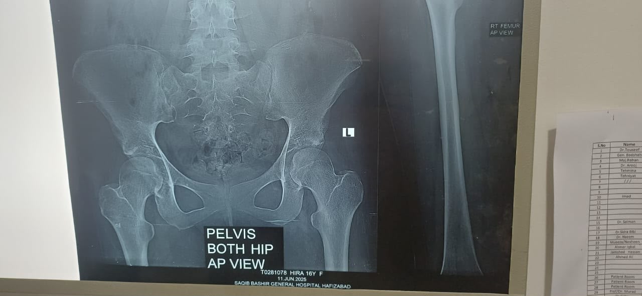 Arthritis patient before X rays