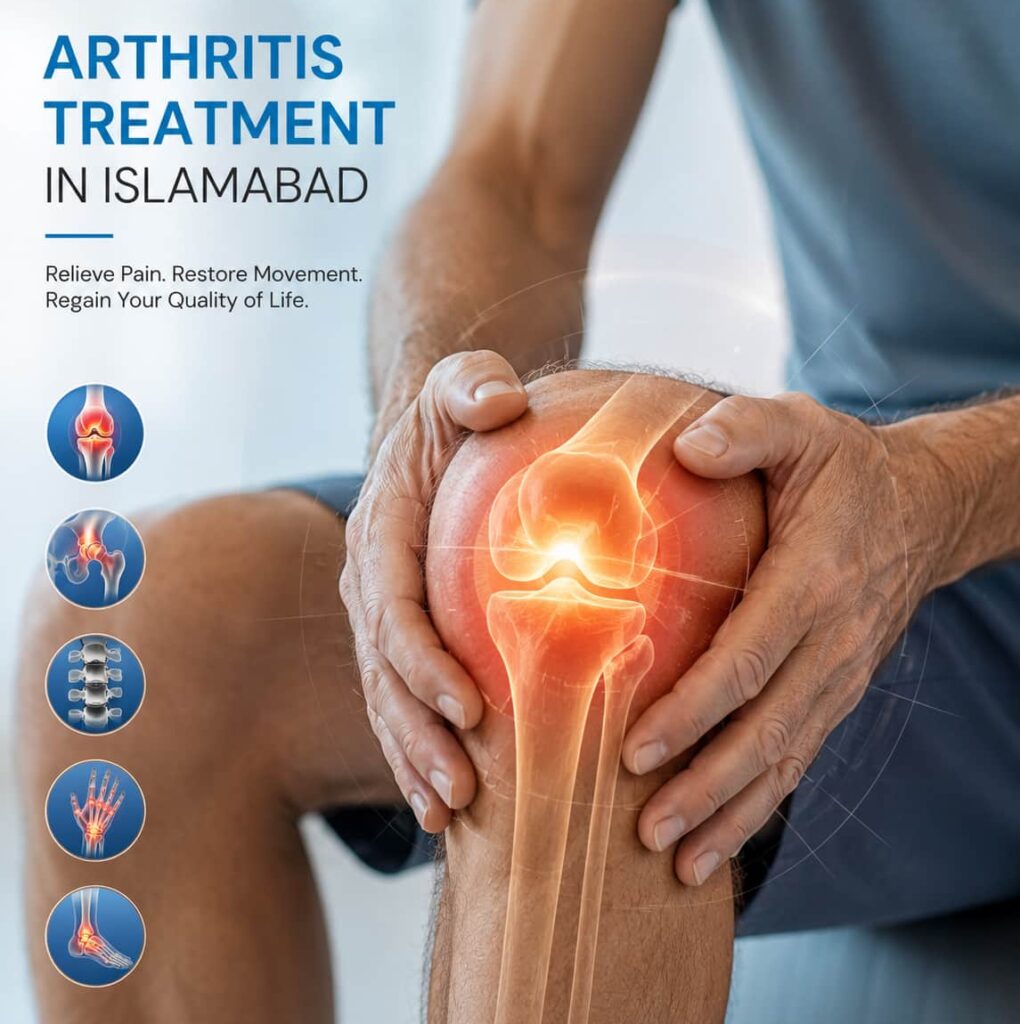 arthrisits Treatment in islamabad