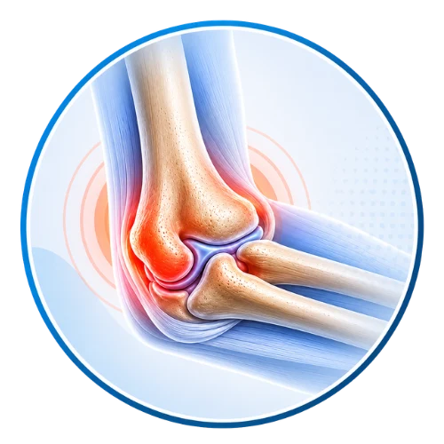 Elbow joint affected by arthritis