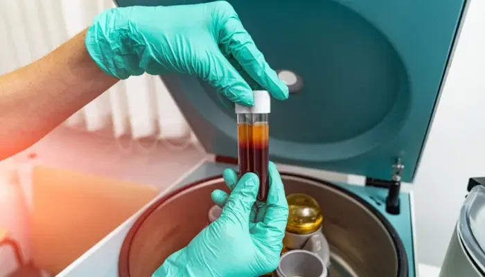 Combat Hair Loss and Regain Thickness