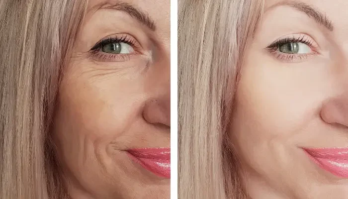 Anti-Aging & Cosmetic Rejuvenation